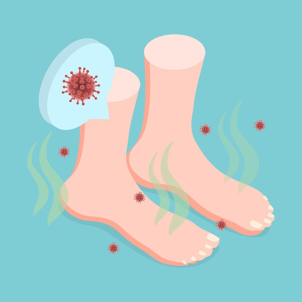 3D Isometric Flat Illustration of Feet Unpleasant Smell, Fungal Lesions vector