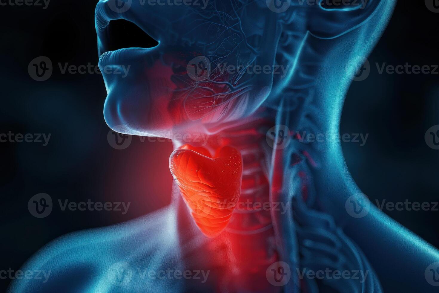 The thyroid gland is highlighted in this image photo