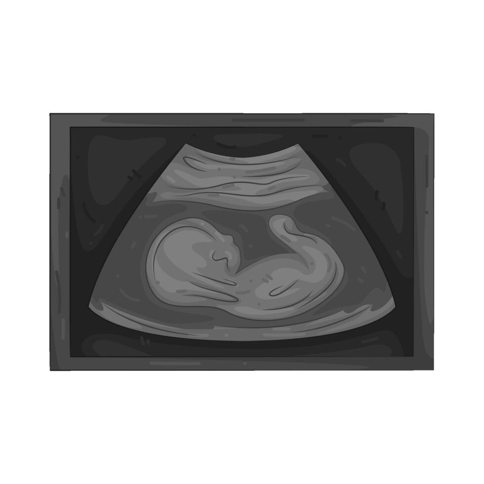 Illustration of a ultrasound vector