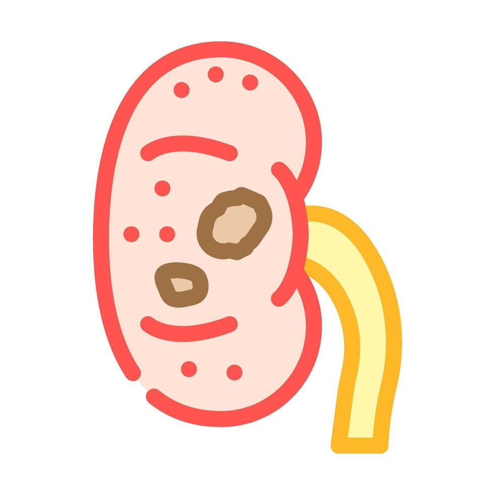 urolithiasis urology color icon illustration vector