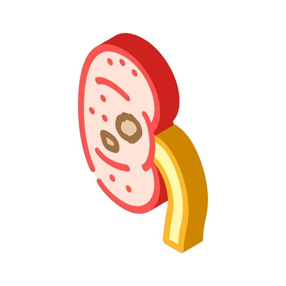 urolithiasis urology isometric icon illustration vector