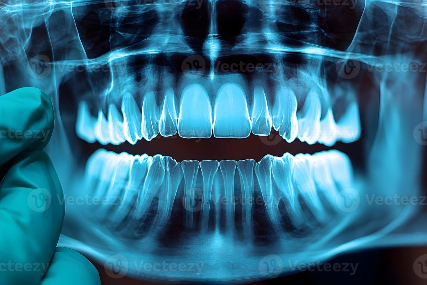 Close-Up Dental X-Ray with Gloved Hand - Medical Imaging for Diagnosis and Treatment photo