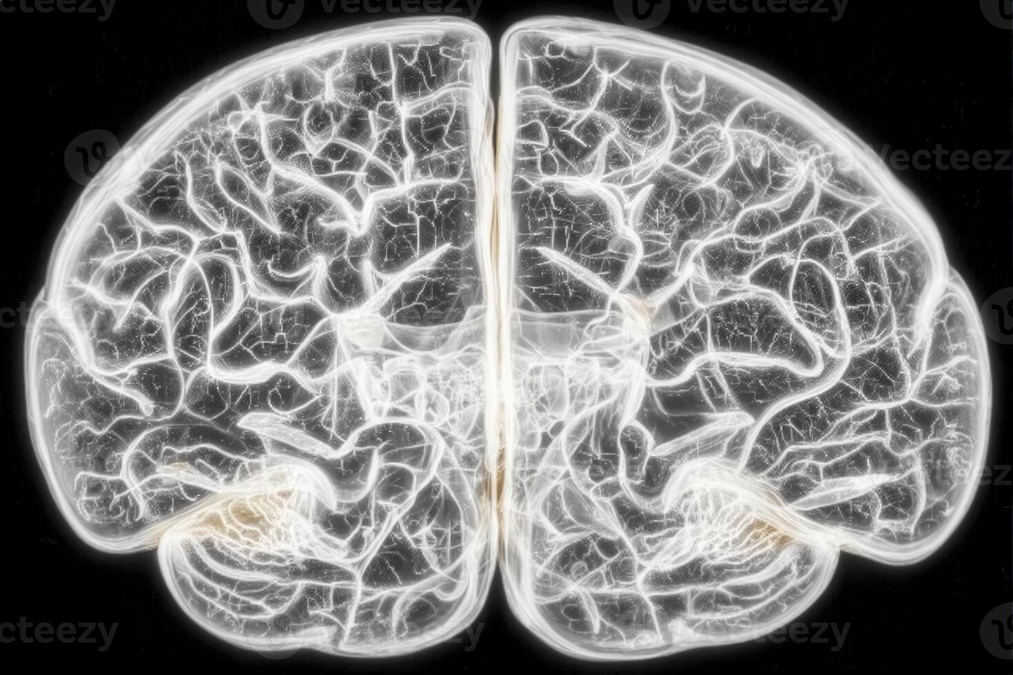 An intricate visual of the human brain shows delicate neural pathways illuminated against a dark background. This artistic interpretation emphasizes connectivity and complexity in brain function. photo