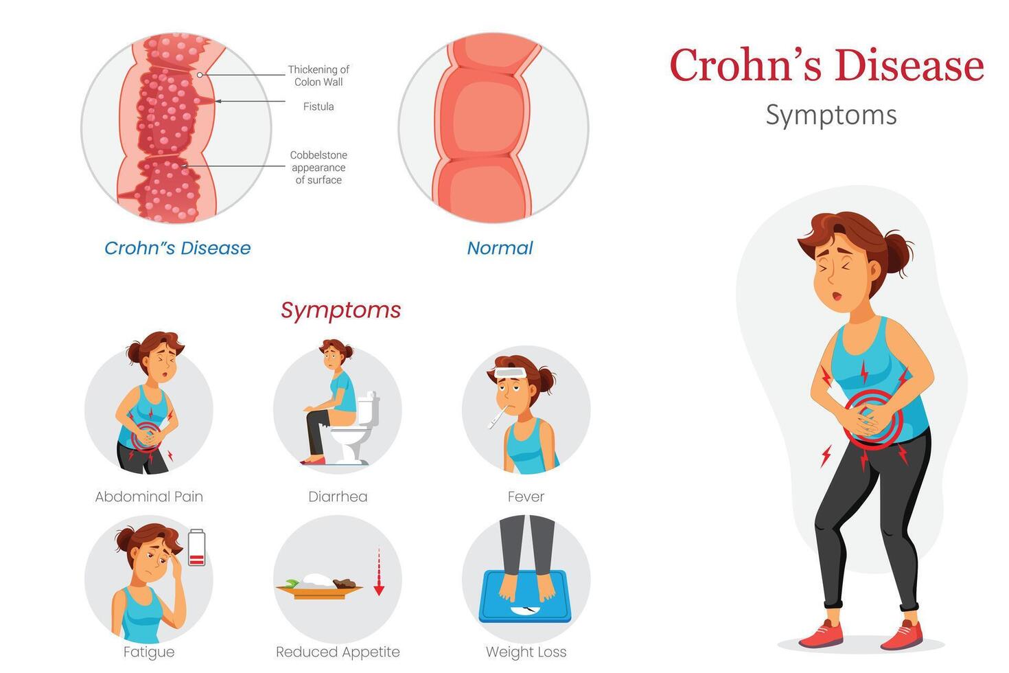 Crohns Disease Diagram Showing Symptoms and Abdominal Pain Example vector