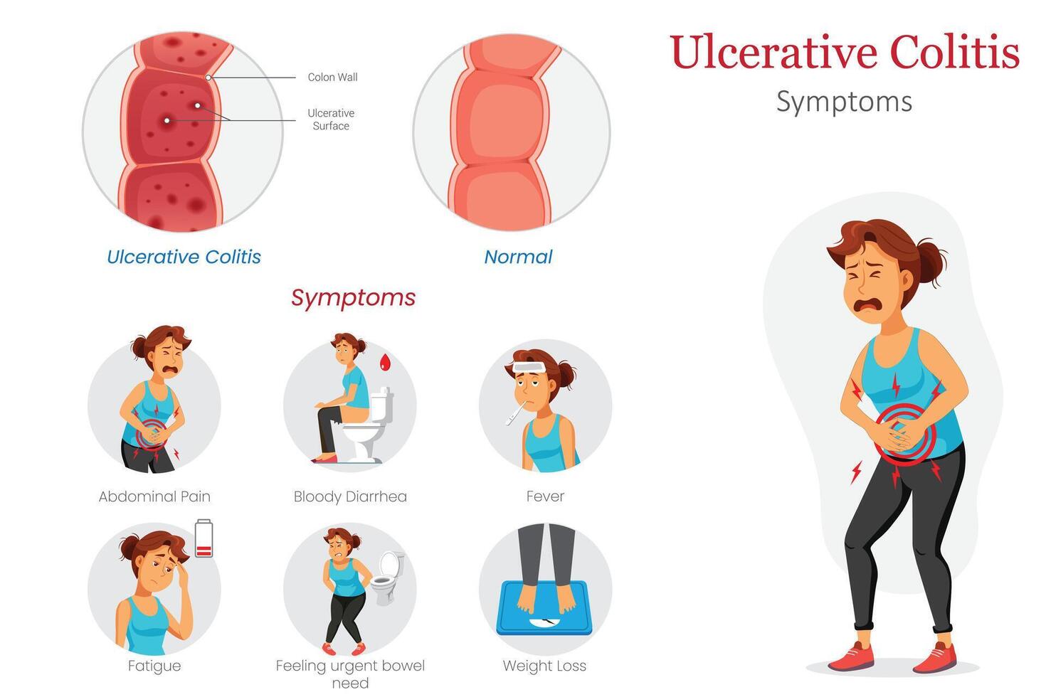 Healthy vs Ulcerative Colitis Intestine Diagram Showing Symptoms vector
