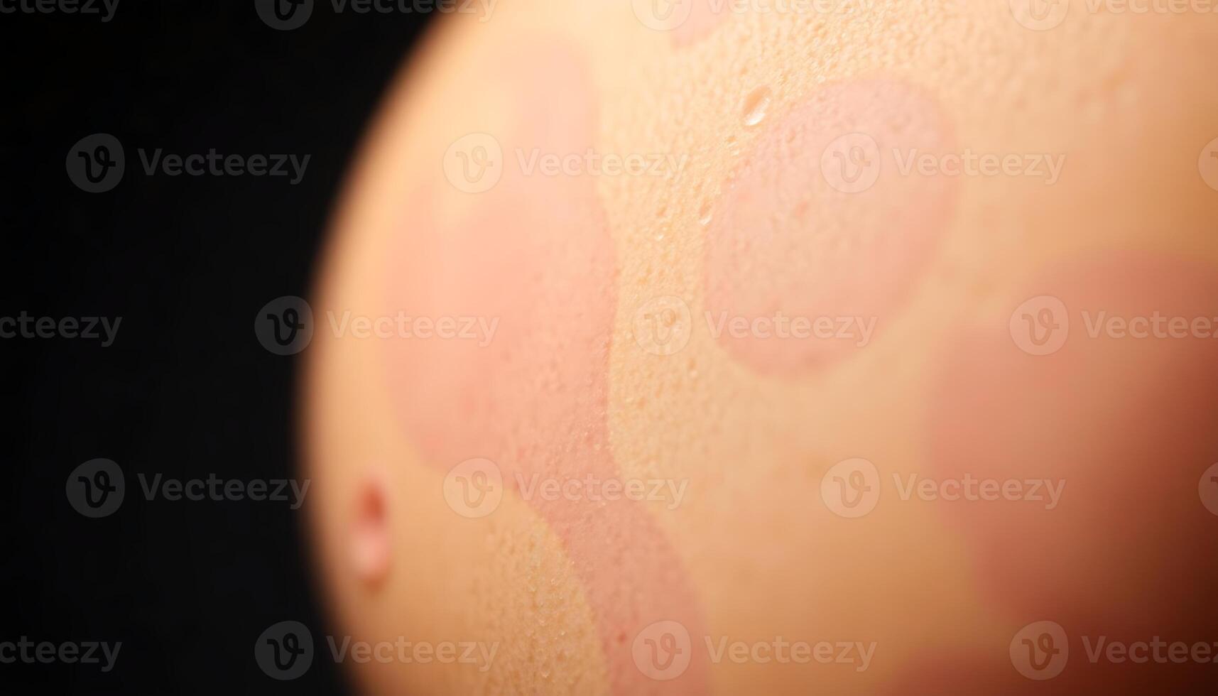 close up of a person's skin with a black background photo