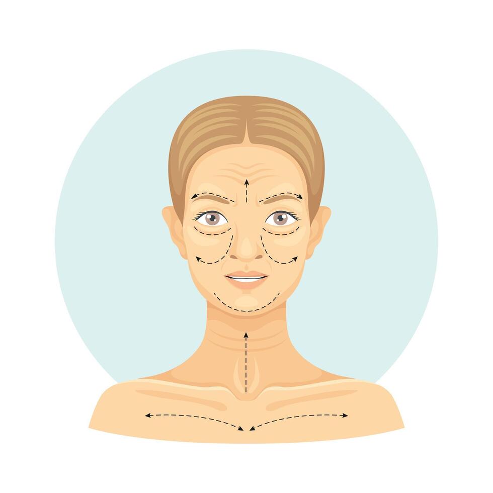 Cosmetic surgery on female face with dotted lines. Plastic surgery illustration vector