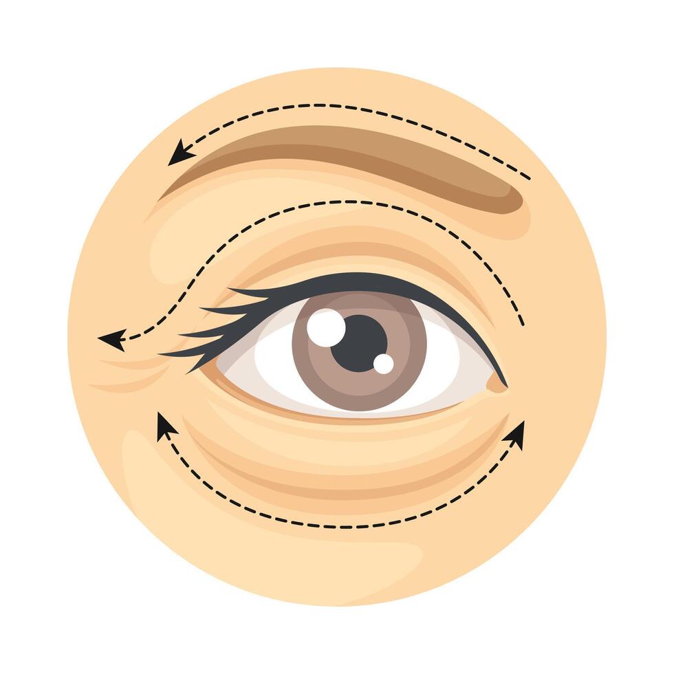 Blepharoplasty cosmetic surgery procedure of female face with dotted lines. Plastic surgery illustration vector