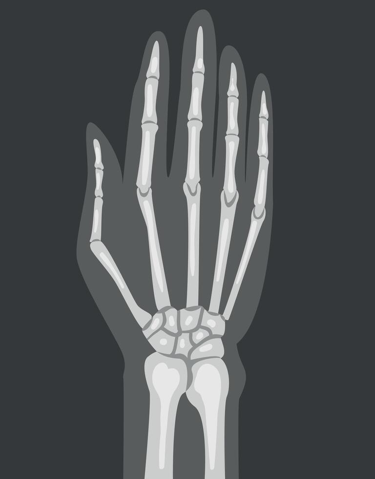 X-ray Film of Hand Illustrated Image for Educational Purpose vector