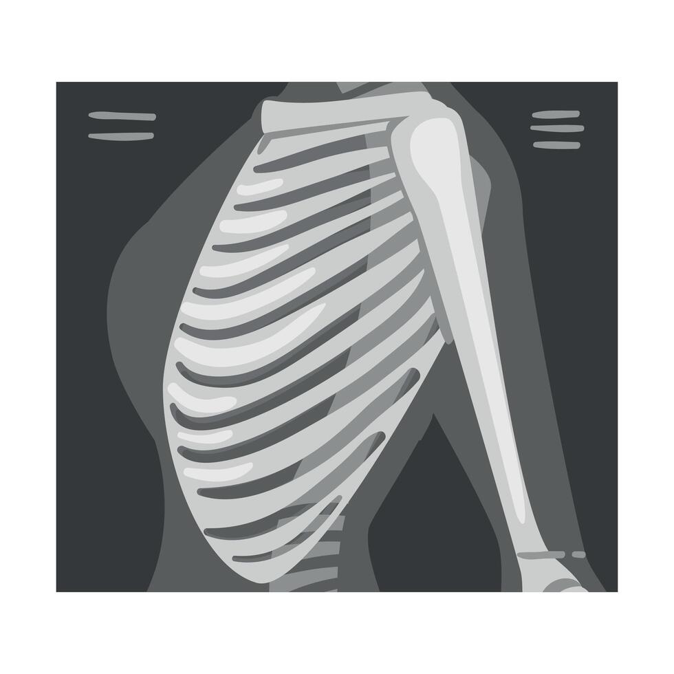 X-ray Film of Ribs Illustrated Image for Educational Purpose vector