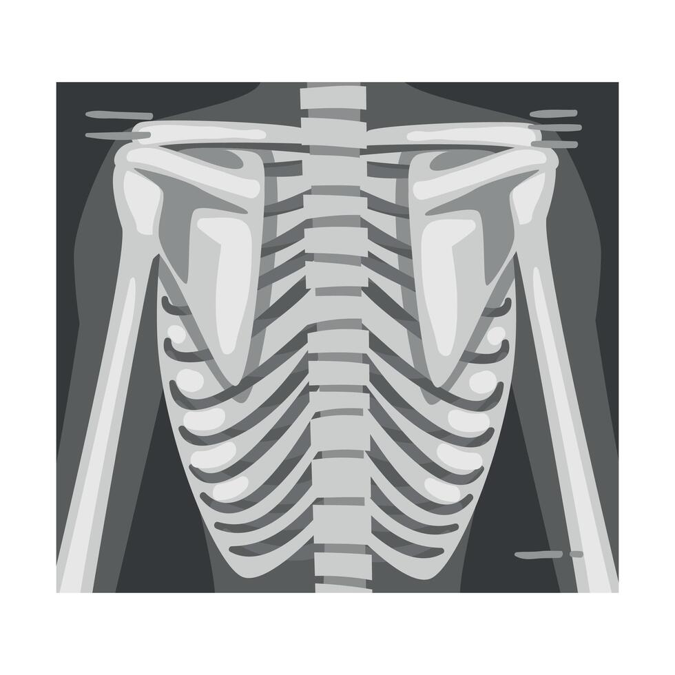 X-ray Film of Spine Illustrated Image for Educational Purpose vector