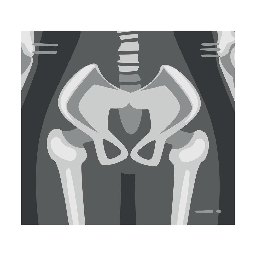 X-ray Film of Coxofemoral Joint Back View Illustrated Image for Educational Purpose vector