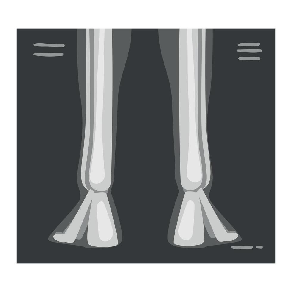 Roentgenograph of Lower Leg Back View Image vector