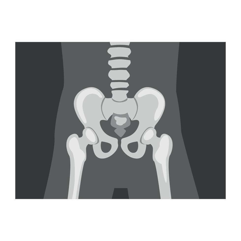 Roentgenograph of Coxofemoral Joint Front View Image vector