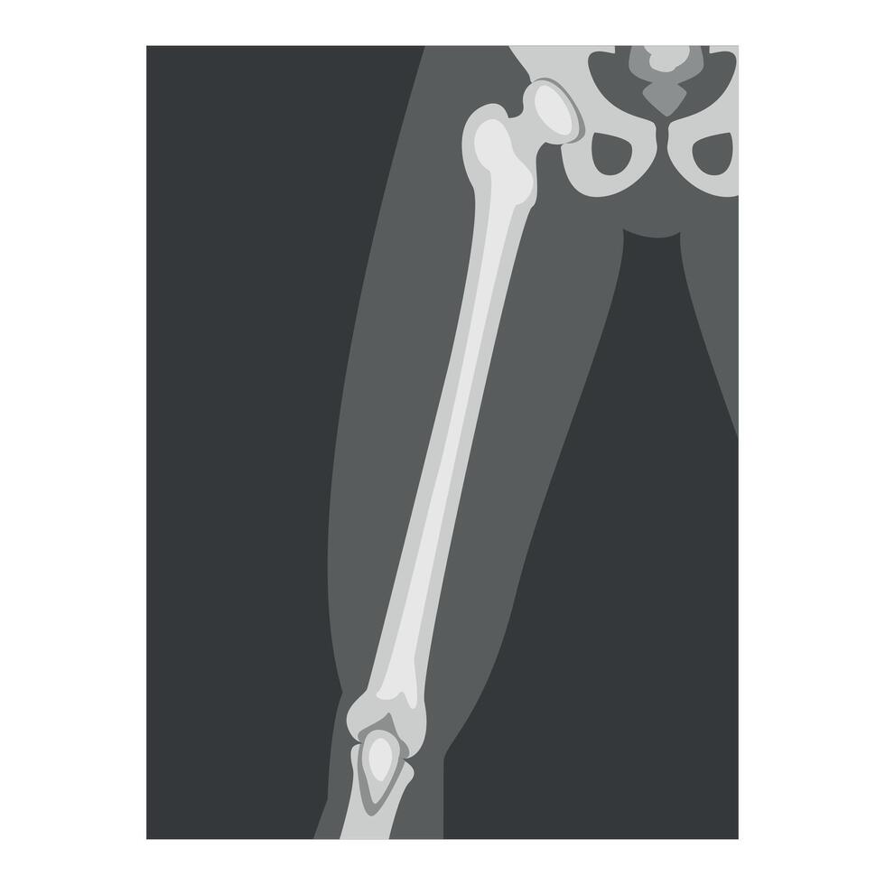 Roentgenograph of Upper Leg Front View Image vector