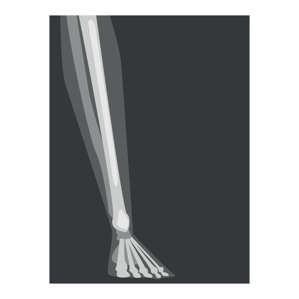 Roentgenograph of Lower Leg Front View Image vector