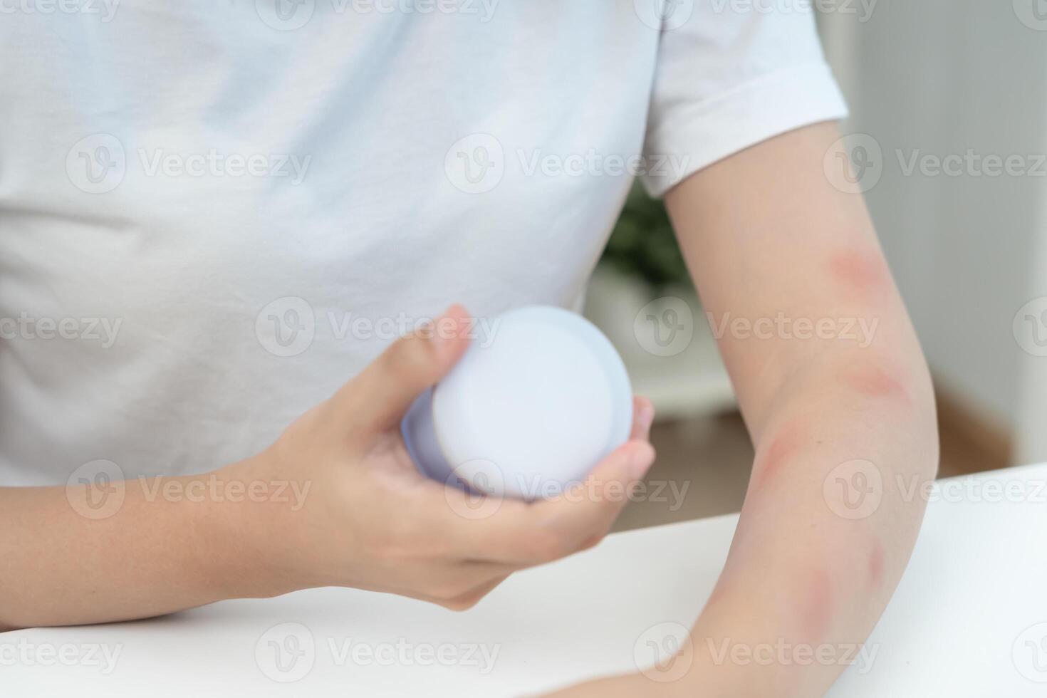 Skin and beauty problems Women have itchy skin and red rashes from cosmetic allergies, steroid allergies, sensitive skin, redness from sunlight, chemical allergies, rashes, insect bites photo