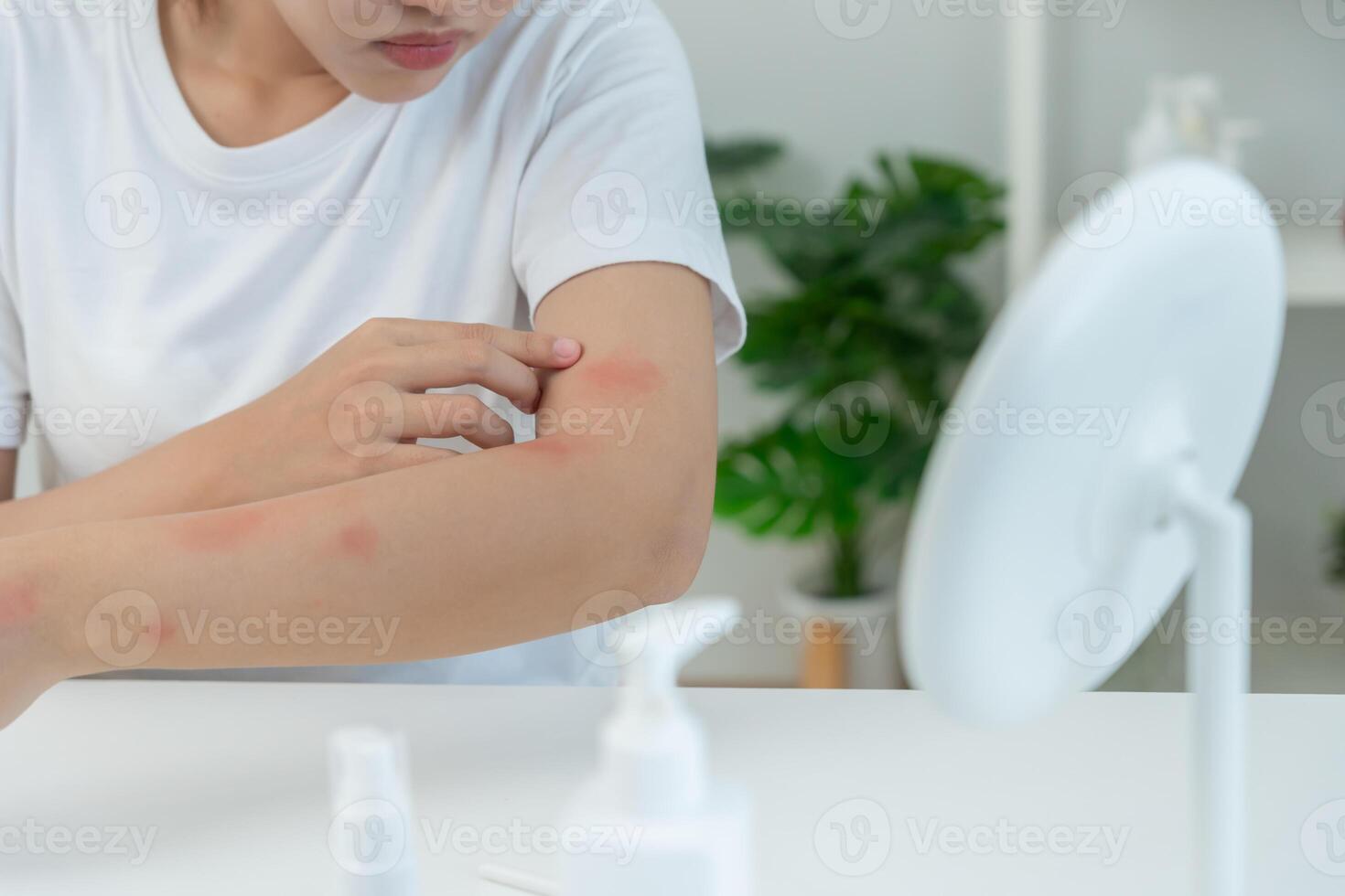 skin problem and beauty. women scratch body has itchy skin from skin allergic, steroid allergy, sensitive skin, red from sunburn, chemical allergy, rash, insect bites, Seborrheic Dermatitis photo