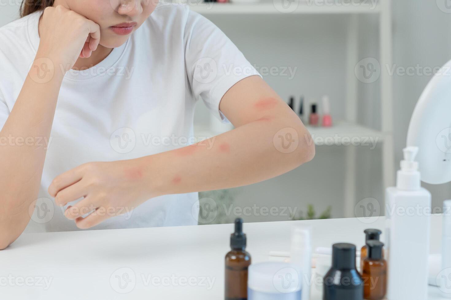Skin and beauty problems Women have itchy skin and red rashes from cosmetic allergies, steroid allergies, sensitive skin, redness from sunlight, chemical allergies, rashes, insect bite. photo