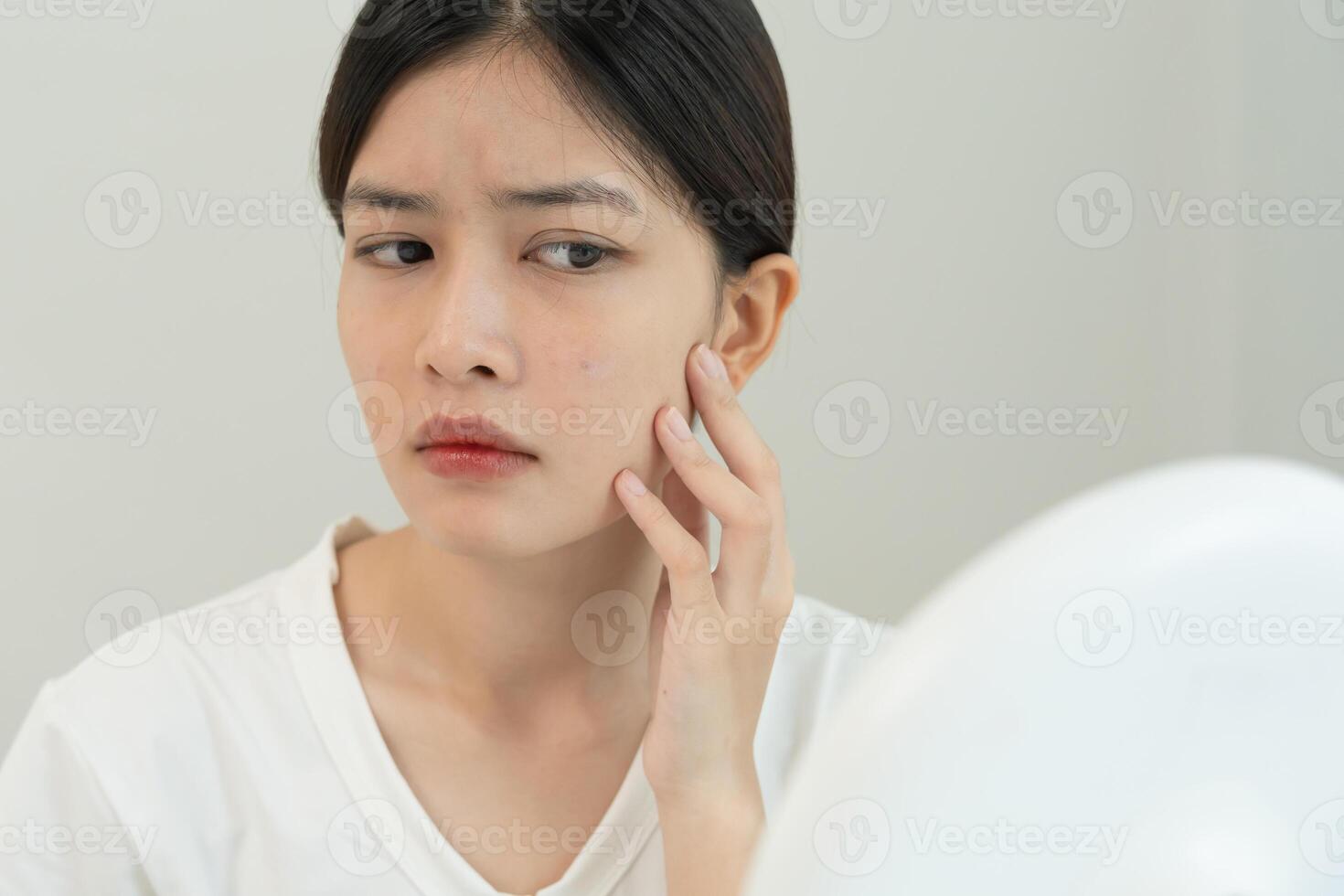 female worried about face Dermatology, rosacea dermatitis, allergic steroids, sensitive skin, red face from sunburn, acne, dry skin, large pores ,rash face, dull, freckles, wrinkle, skin problem, photo