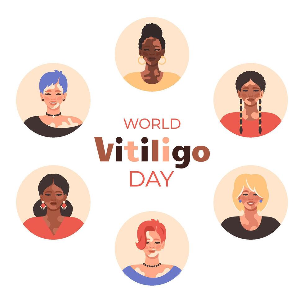 Diverse women with vitiligo patches. World vitiligo day. Happy People with vitiligo smiling. Promoting acceptance, equality and skin positivity. flat cartoon Illustration vector