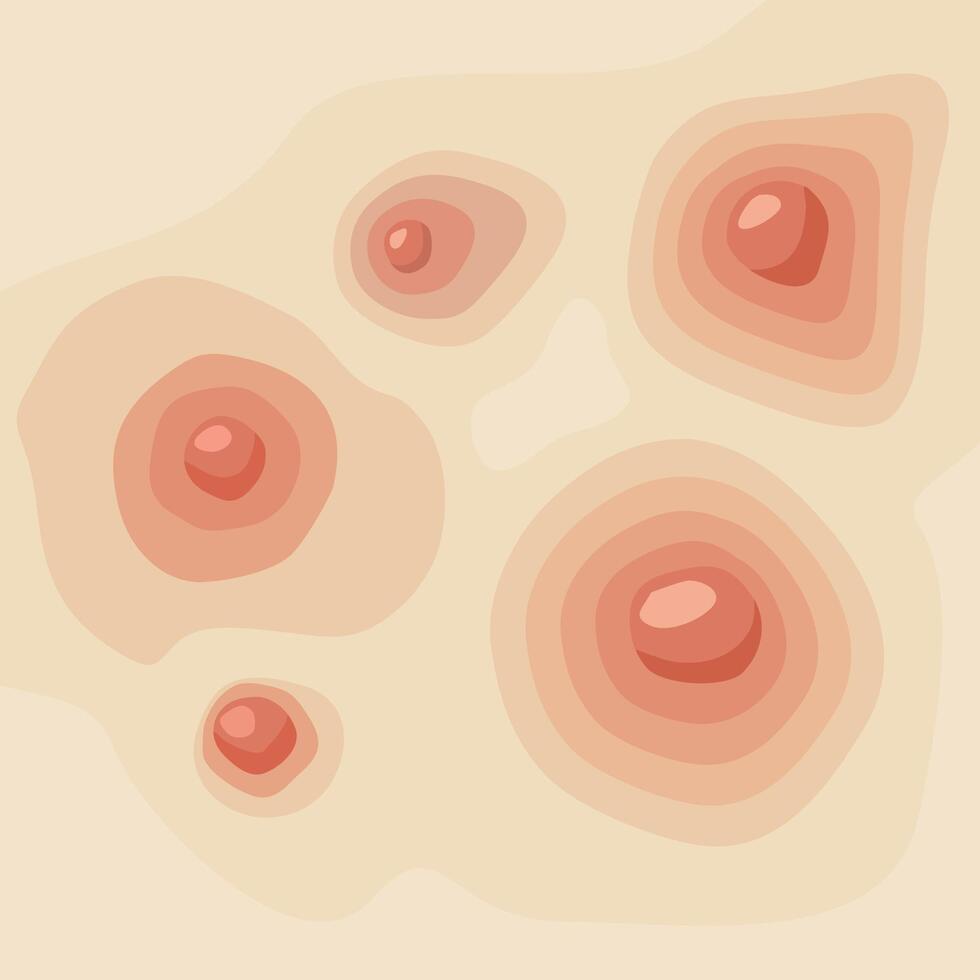 Acne texture, pimple different shapes and colors on fair skin. Cosmetic infographics, skin care background vector