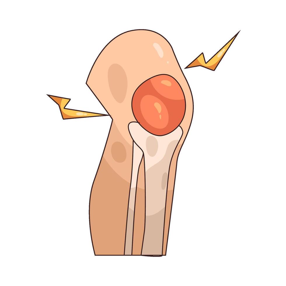 illustration of joint pain vector