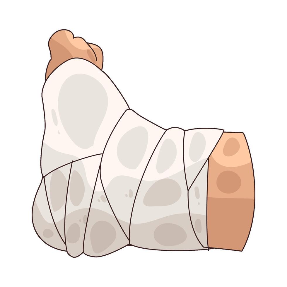 Illustration of Leg Cast vector