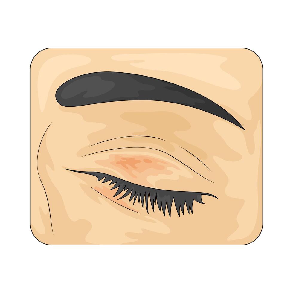 bruise on the eye vector