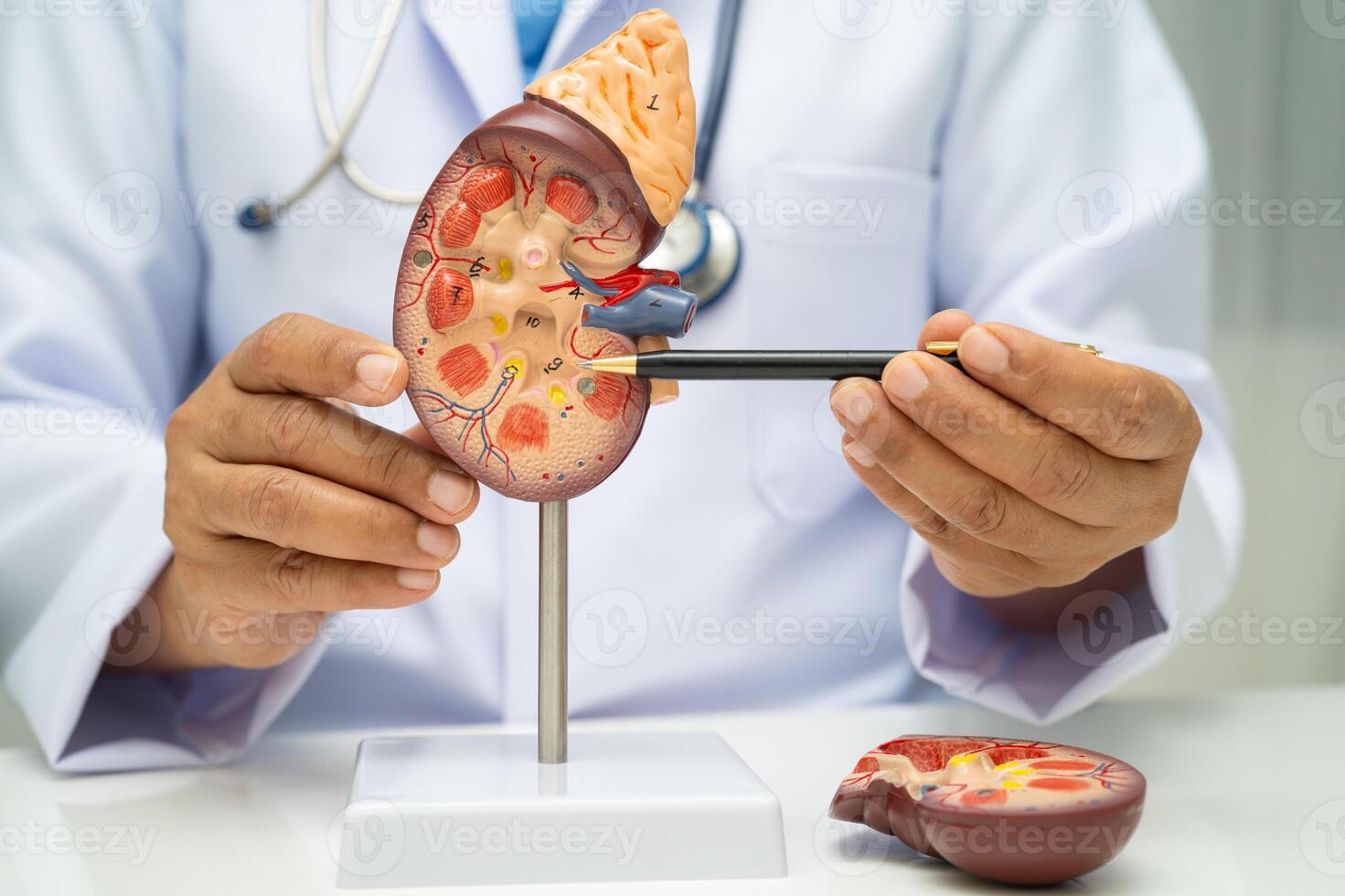 Chronic kidney disease doctor with model for treatment urinary system, urology, Estimated photo