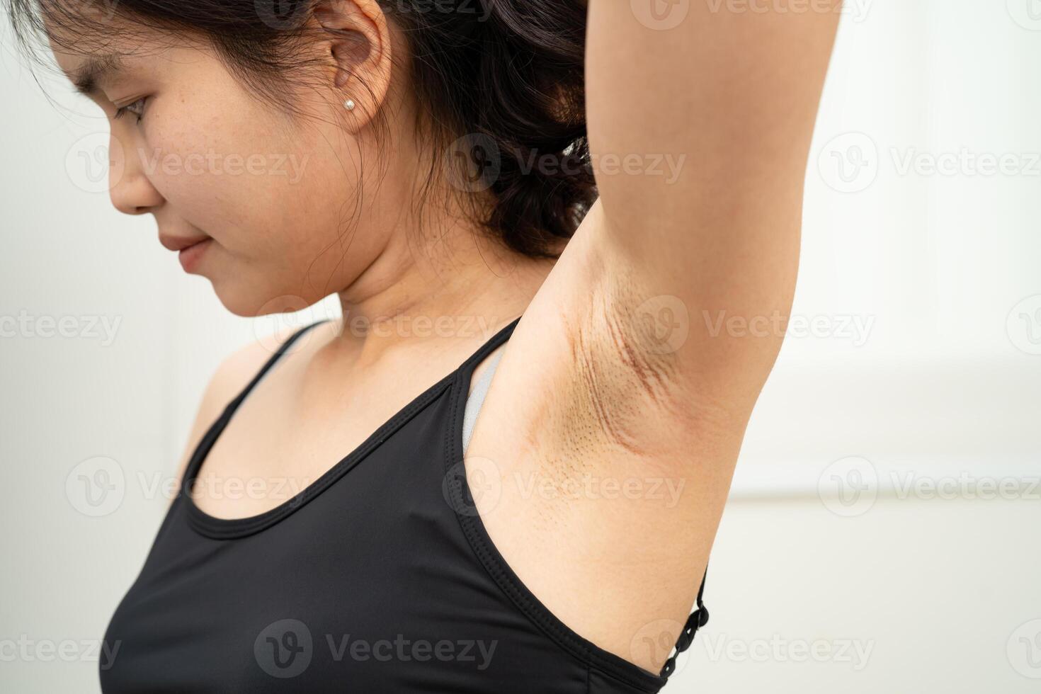 woman have problem black armpit beauty skin photo