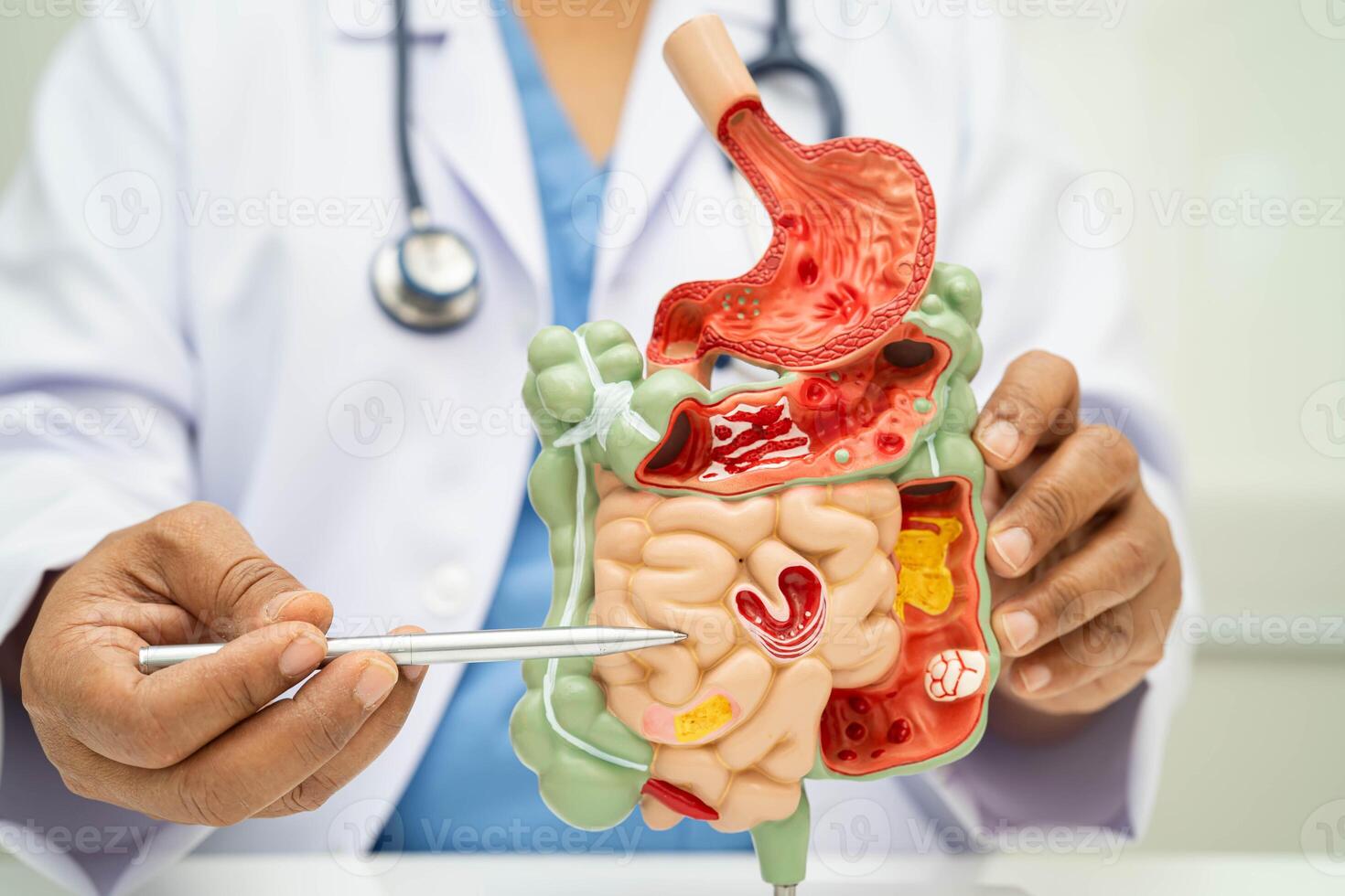 Digestive system with stomach and intestine, photo
