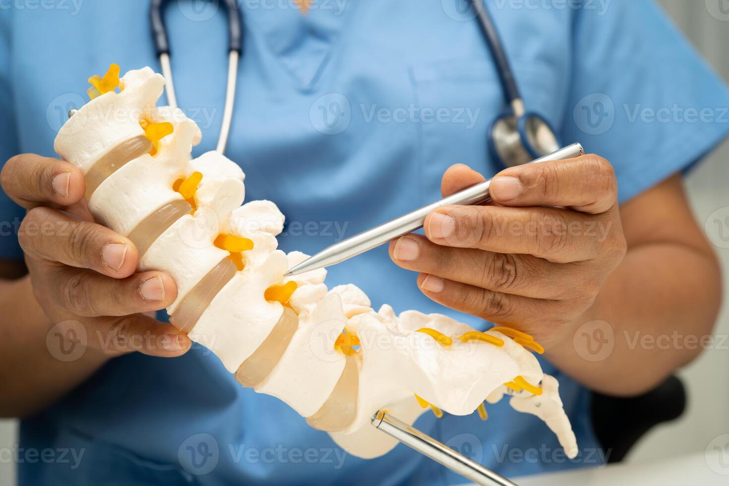 doctor holding spinal nerve and bone model, Lumbar spine displaced herniated disc fragment for treatment medical in the orthopedic photo