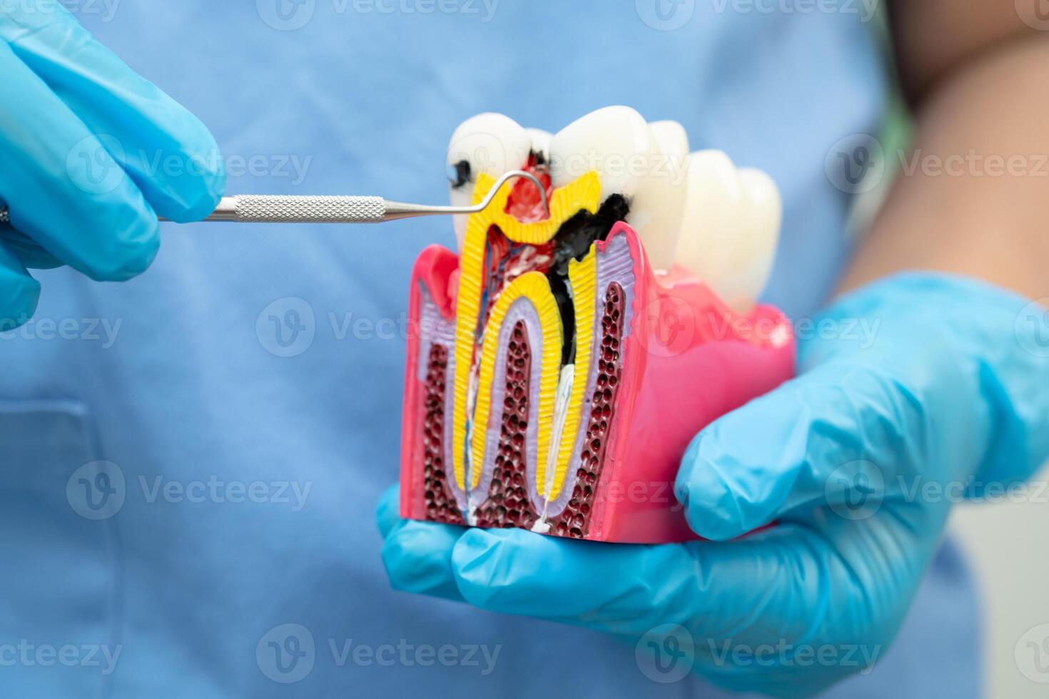Teeth root dental model with tool for dentist use to cleaning photo