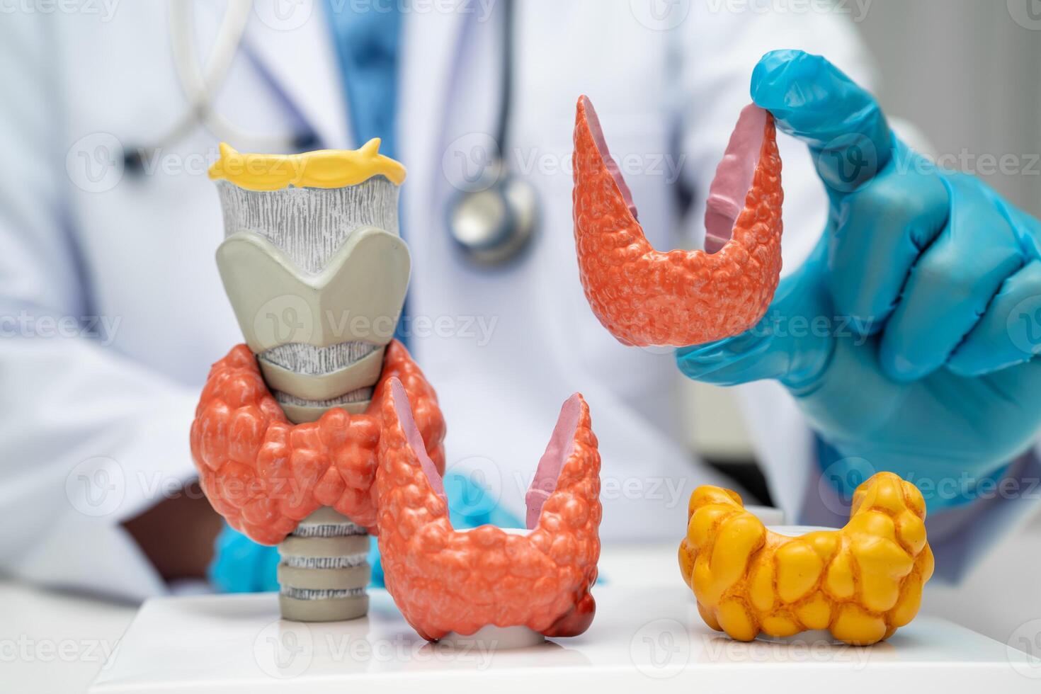Hyperthyroidism Overactive Thyroid, Thyroid Lymphoma, Asian doctor with thyroid gland human anatomy photo