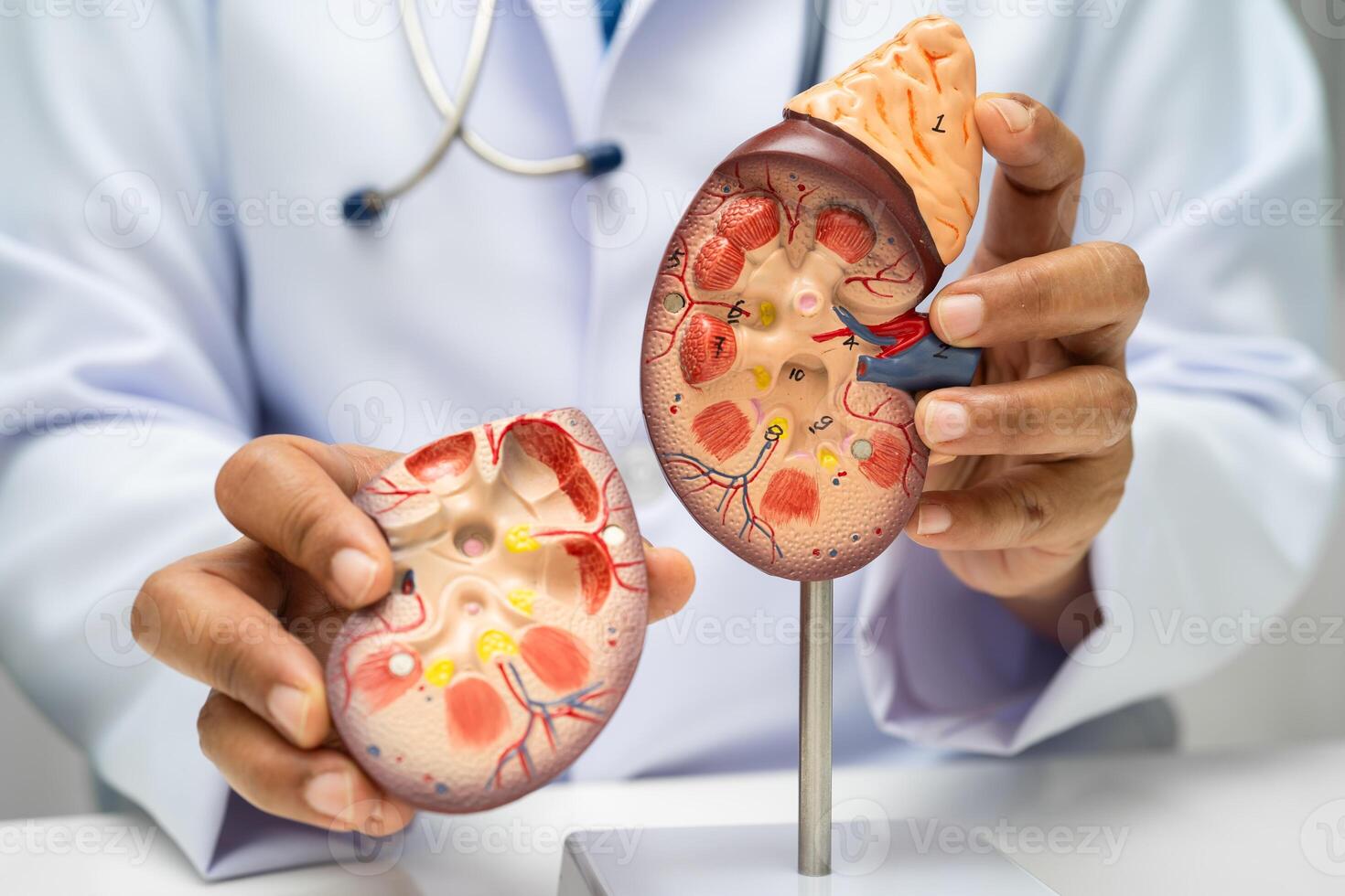 Chronic kidney disease doctor with model for treatment urinary system, urology, Estimated glomerular filtration rate eGFR. photo