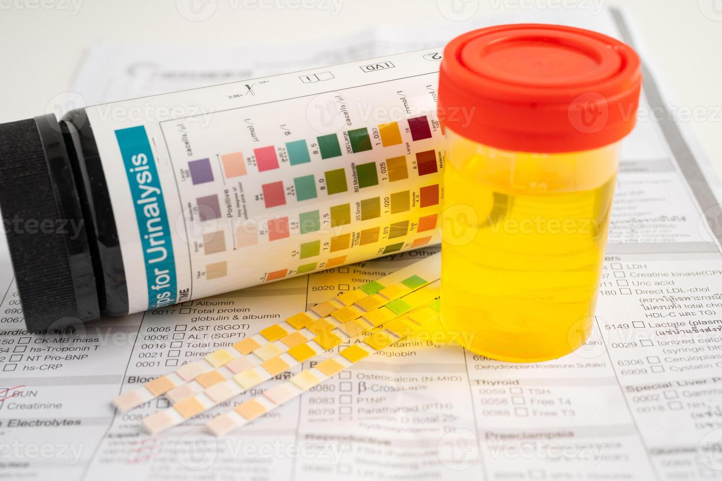 Urinalysis, urine cup with reagent strip pH paper test and comparison chart in laboratory. photo