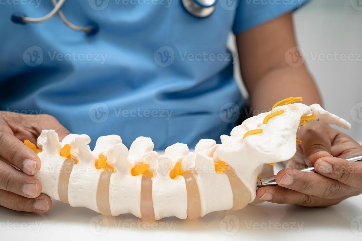 doctor holding spinal nerve and bone model, Lumbar spine displaced herniated disc photo