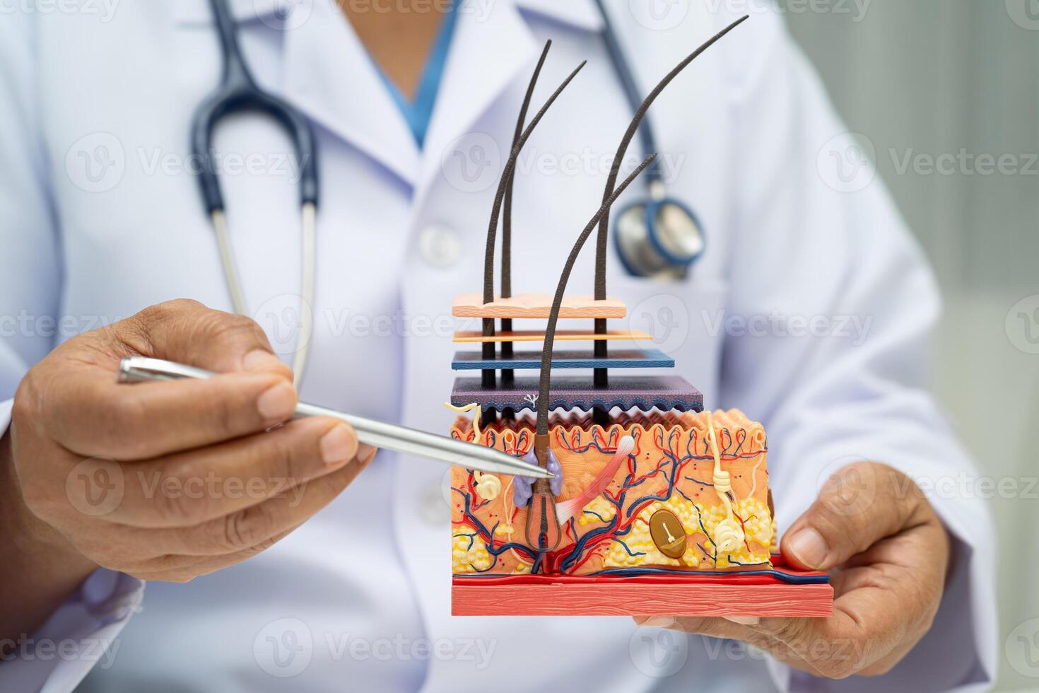 Hair transplant dermatologist doctor holding skin structure anatomy model for photo