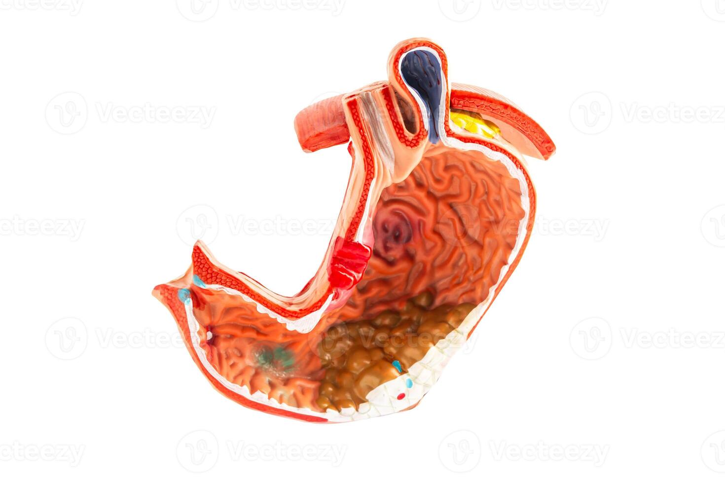 Stomach model isolated on white background with clipping path. photo