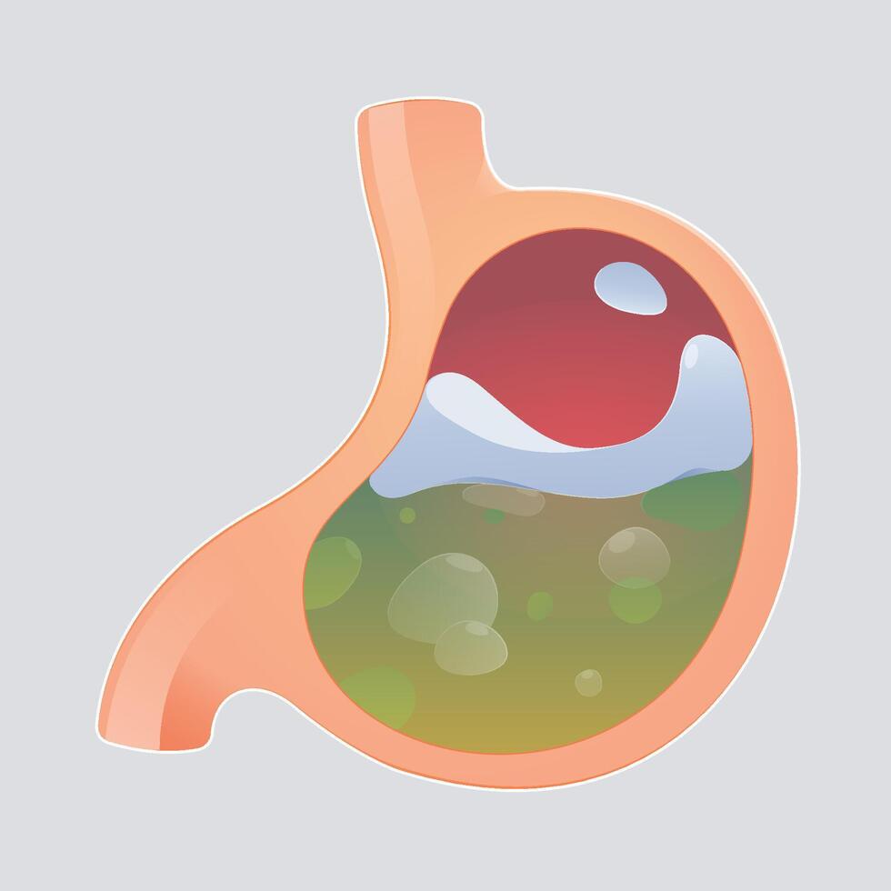 Cartoon image of liquid medicine easing acid reflux or reducing stomach acid. vector