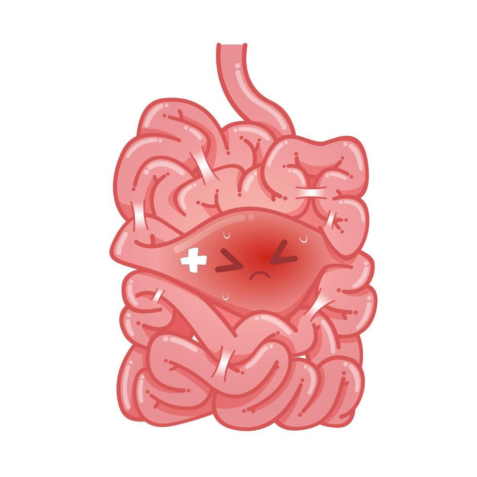 Small bowel obstruction vector