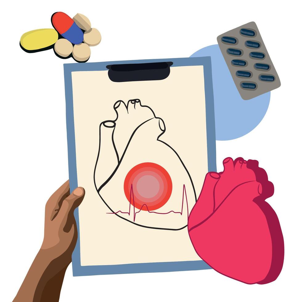 Heart disease treatment. Heart disease diagnosis. Electrocardiogram study. Heart rhythm. Ischemic heart disease. vector