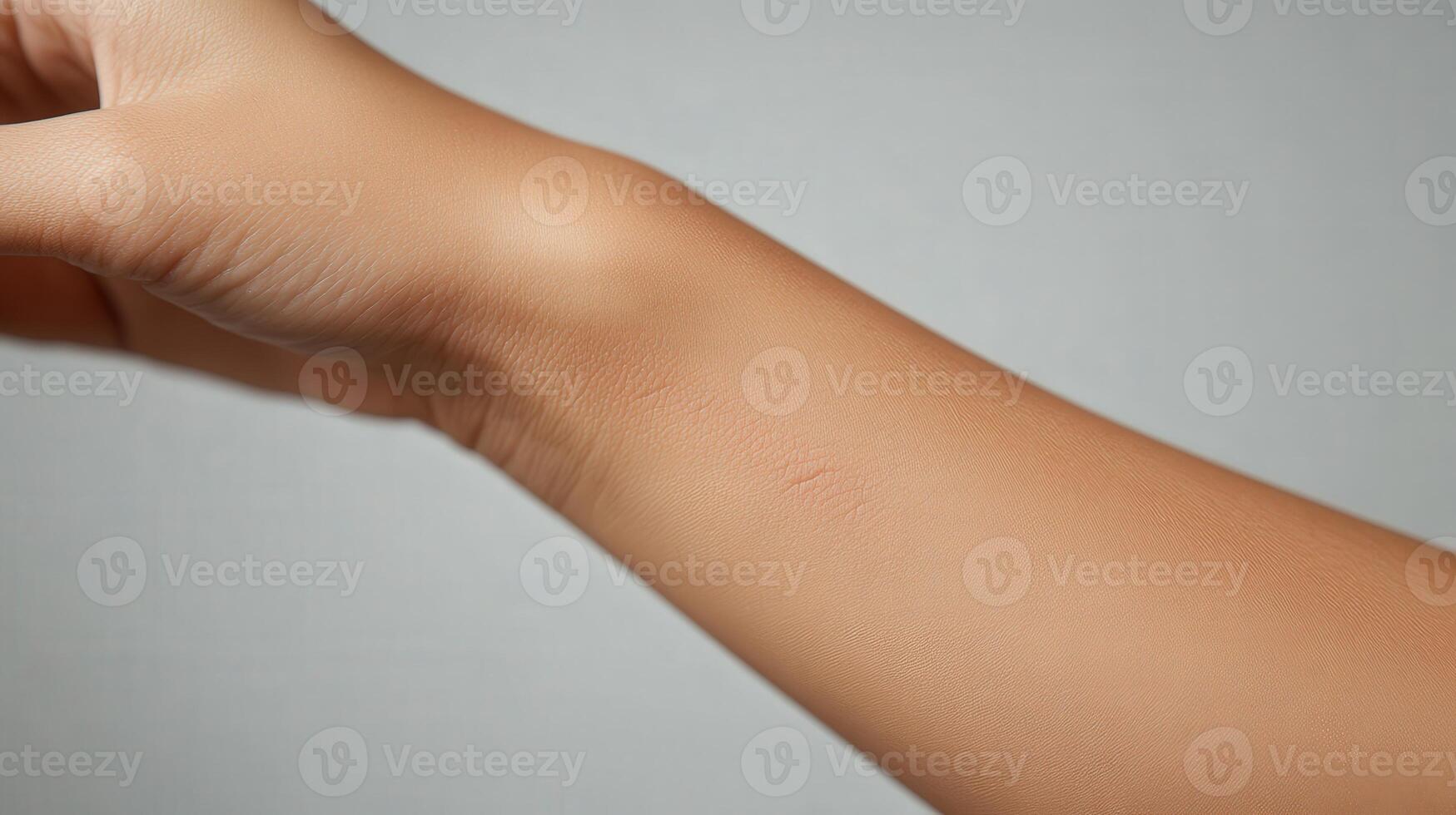 Close-up view of light skin with faint reddish marks on the forearm. photo
