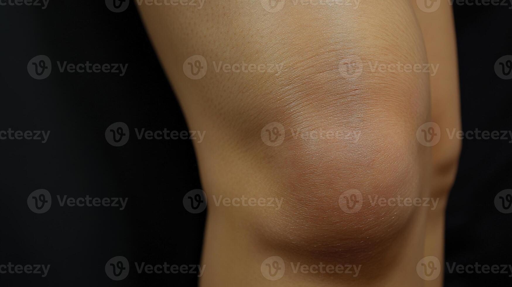 Close-up view of a human knee joint with visible skin texture. photo