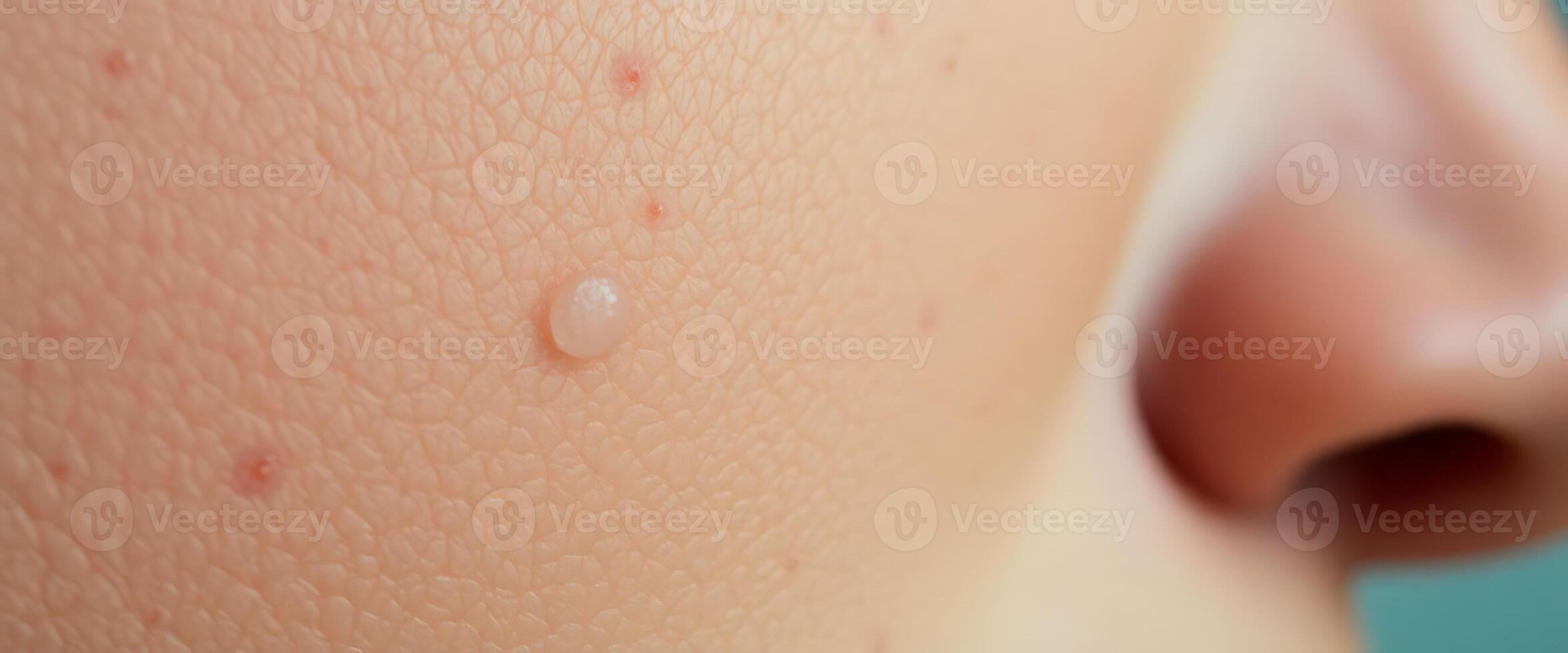 close up of a person's nose with a lot of brown spots on photo