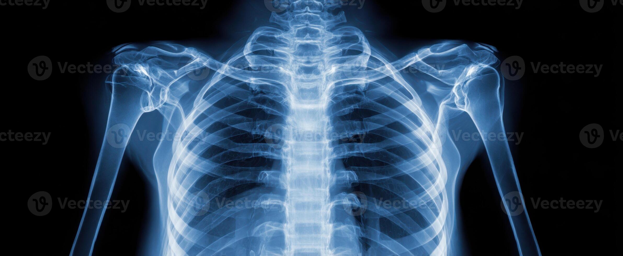 The detailed x-ray image showcasing the human skeletal system and ribcage. photo