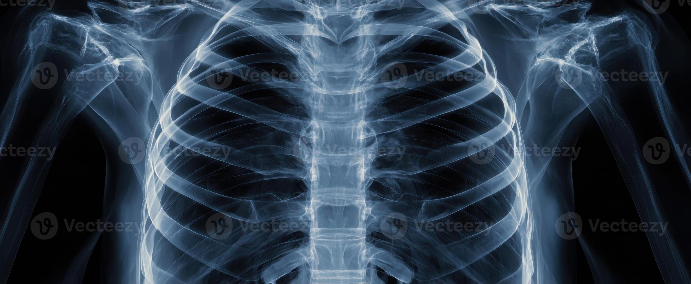 The detailed anatomy of a human chest shown through an X-ray image. photo