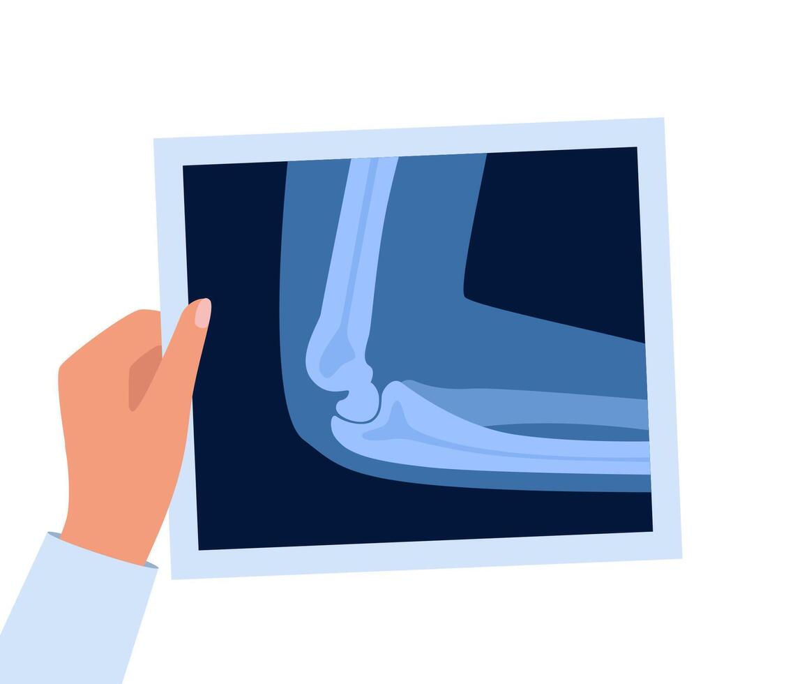 Xray scan of elbow joint. Anatomical structure, care and diagnosis for pain in arm. Roentgen shot in doctors hand vector