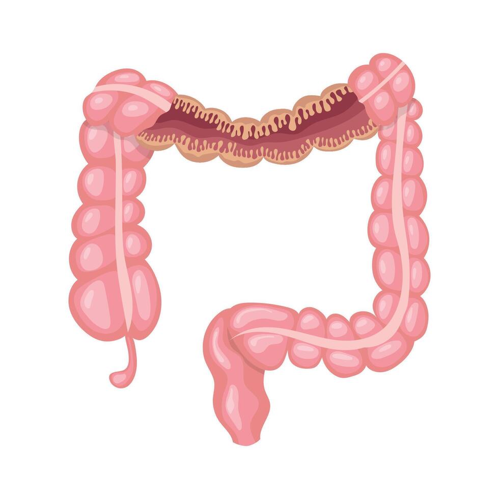 Large intestine showing its internal structure, including the appendix vector